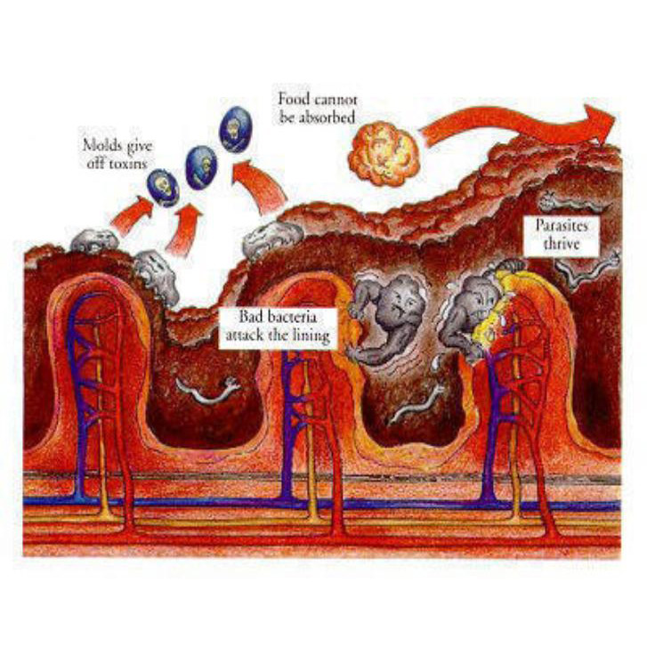 Bowel, Colon & Intestine Cleanse